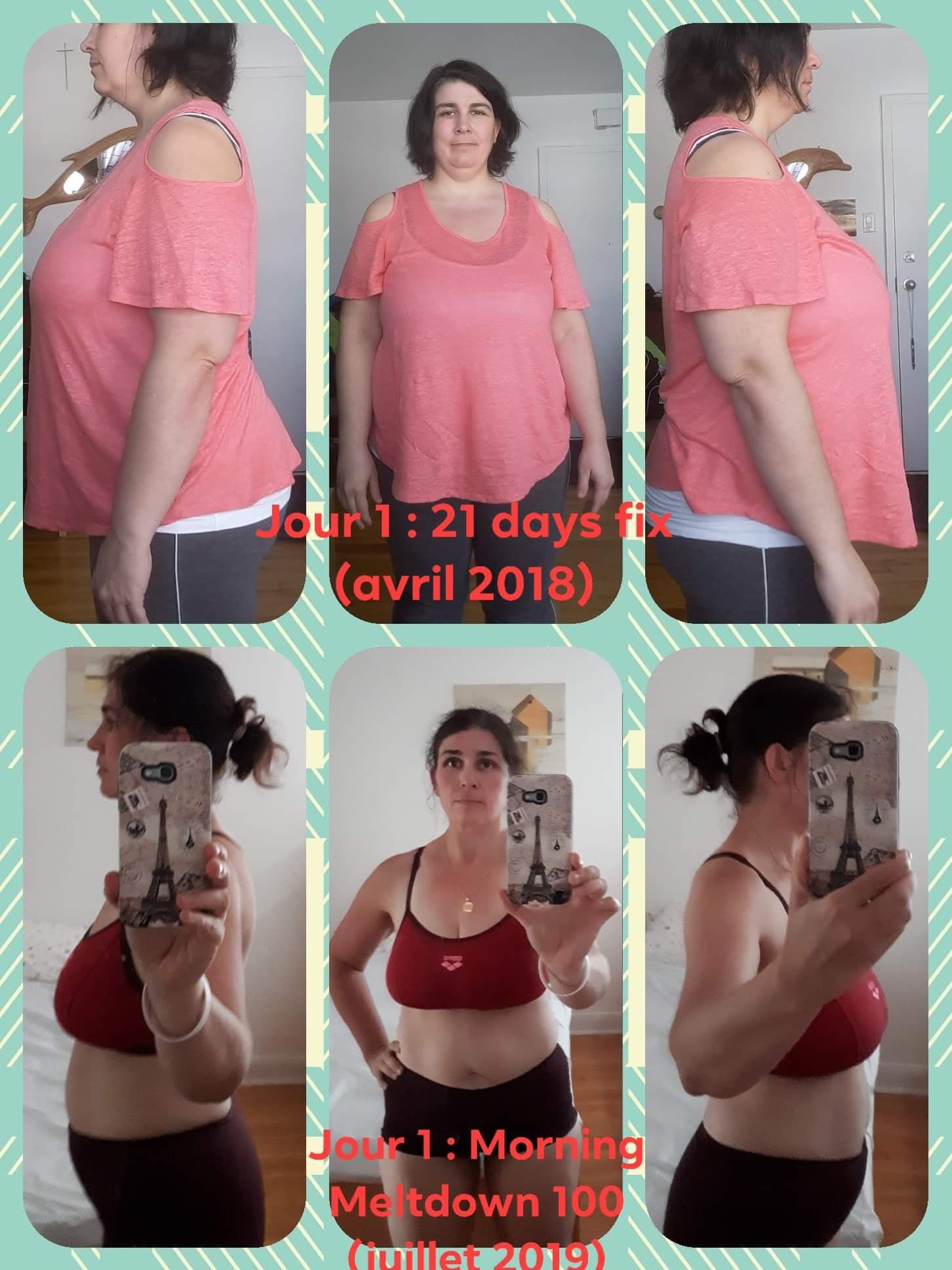 Aurore Résultats avant/après